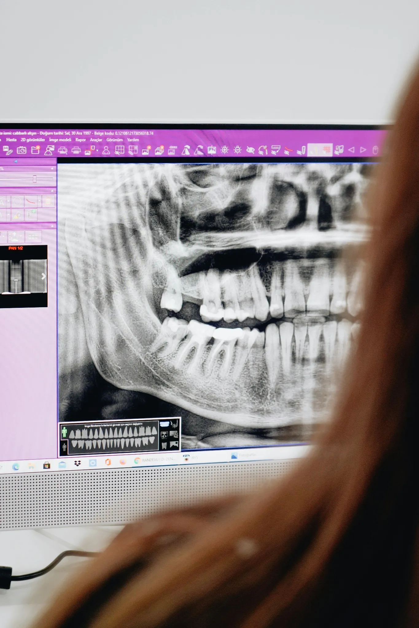 Radiologia i Radiofizjografia